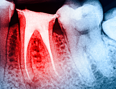 One & Only Dental - treatment